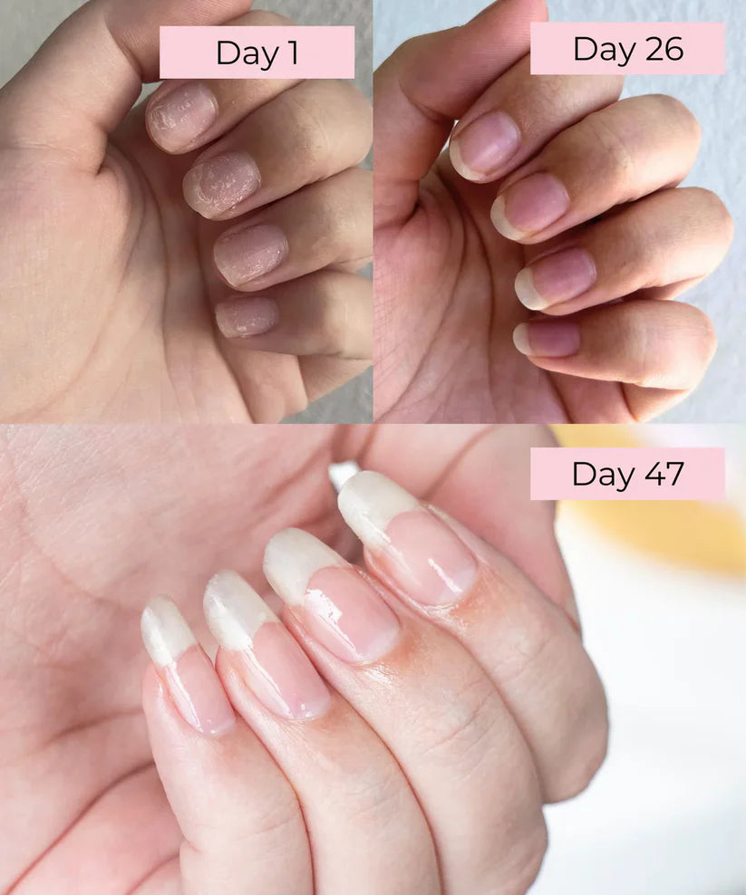 Nailz Healing & Growth